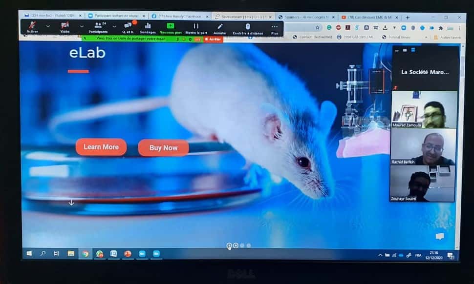 #Animalelectrophysiology #PainManagement #Apnea #Seizure #LowerLimpControl #Locomotion #Alzheimer #Parkinson #BladderControl #Epilepsy #UpperLimbControl #CentralAuditoryProcessingDisorder (CAPD) #Singleunite #singleneuron #animalelectrophysiology #fieldpotential #electrophysiology #science # neurotransmitter #freelymoving #kindling #slicerecording #extracellular #Patchclamp #intracellular #animallab #invivo #invitro #neuroscience #animalmodel #electrophysiologyrecording #electrophysiological #SNR #NCV #LTP #LFP #ecg #ecog #ERP #steriotaxic #amplifier