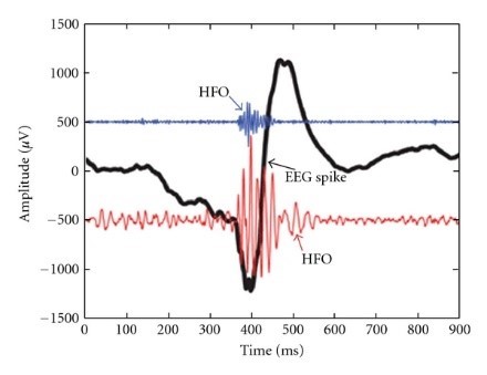 128 channel EEG ERP for research BCI human electrophysiology