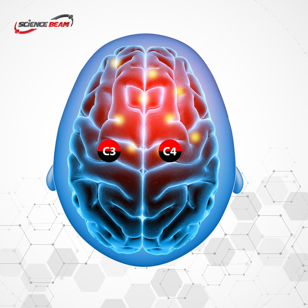 motor recovery in stroke