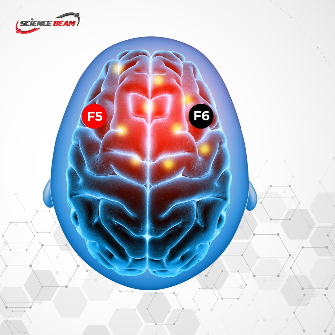 Broca's Aphasia